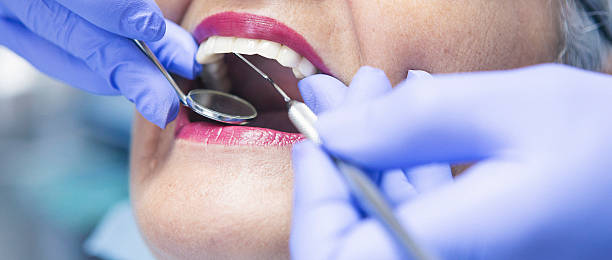 Best Emergency Dental Care for Broken or Chipped Teeth in Pines Lake, NJ